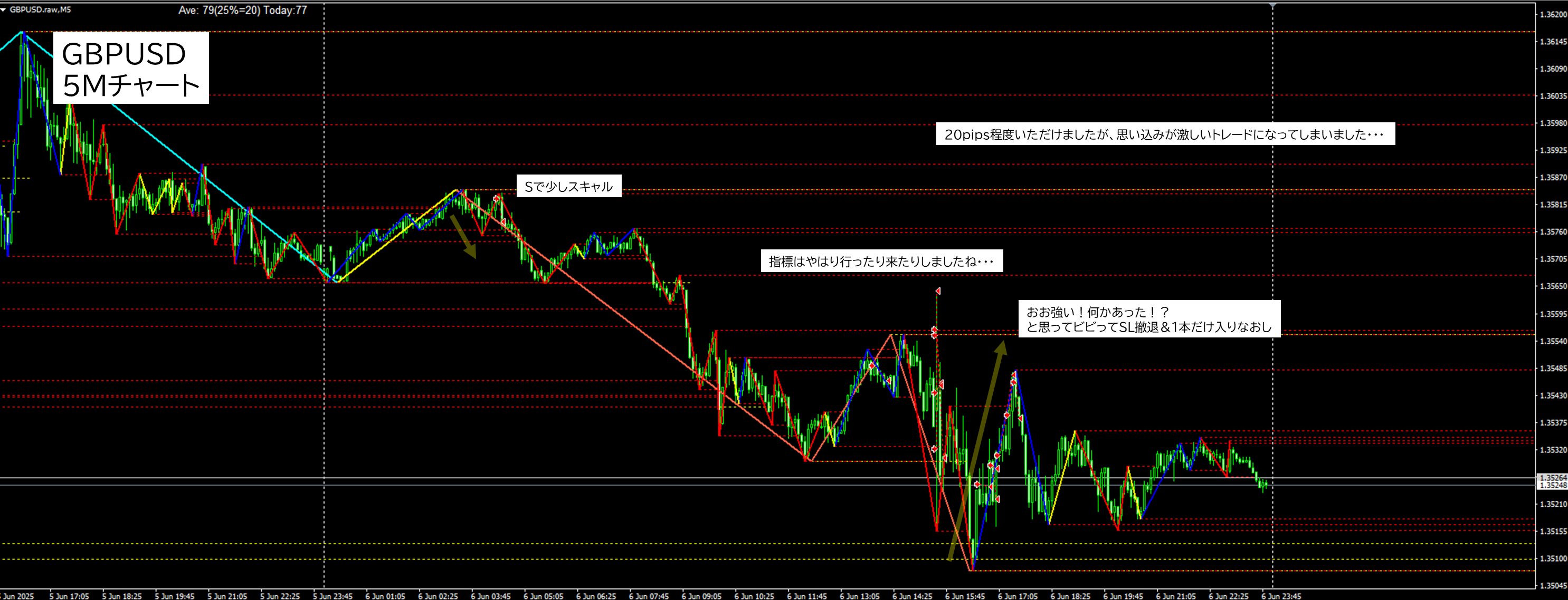 2025年6月6日 GBPUSD(ポンドドル)5分足チャートにおけるジグザグ波形分析